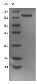 Recombinant Rat Neuroendocrine convertase 1(Pcsk1)