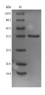 Recombinant Mouse Monoglyceride lipase(Mgll)