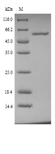 Recombinant Mouse Alanine aminotransferase 1(Gpt)