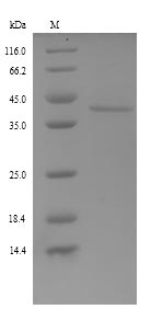 Recombinant Rat Fetuin-B(Fetub)