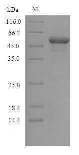 Recombinant Human Glycogen synthase kinase-3 beta(GSK3B)