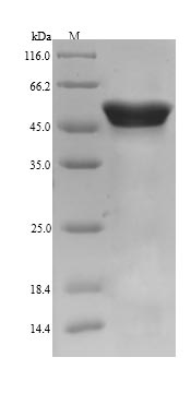 Recombinant Pig Calreticulin(CALR)
