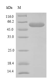 Recombinant Mouse F-box/WD repeat-containing protein 10(Fbxw10),partial