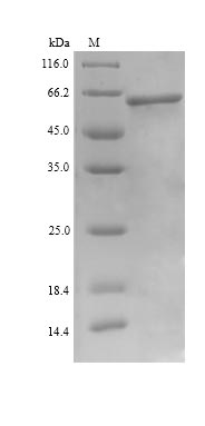 Recombinant Human UDP-N-acetylhexosamine pyrophosphorylase(UAP1)