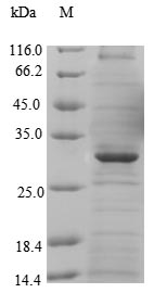 Recombinant Human Major facilitator superfamily domain-containing protein 8 (MFSD8),partial