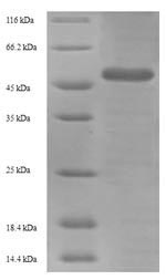 Recombinant Influenza A virus Hemagglutinin(HA)