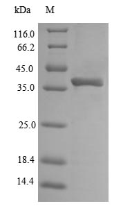 Recombinant Escherichia coli Outer membrane protein A(ompA),partial