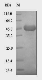 Recombinant Escherichia coli Lipid kinase YegS(yegS)