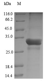 Recombinant Theragra chalcogramma Parvalbumin beta-1