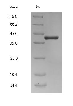Recombinant Human Cyclin-K Isoform 2(CCNK),partial