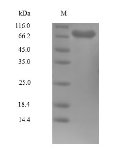 Recombinant Human Serine/threonine-protein kinase PLK1(PLK1),partial