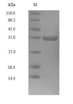 Recombinant Human Cyclin-dependent kinase4(CDK4)