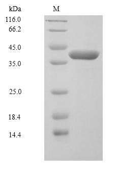 Recombinant Human Dual specificity mitogen-activated protein kinase kinase 6(MAP2K6)