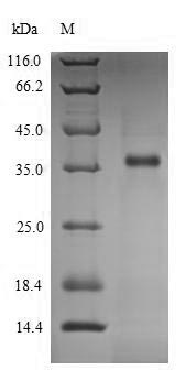 Recombinant Human L-lactate dehydrogenase C chain (LDHC) ,partial