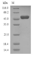 Recombinant Human Wilms tumor protein(WT1)