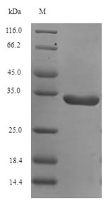 Recombinant Human Protein DJ-1(PARK7) ,partial