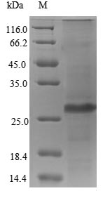Recombinant Human cytomegalovirus 65KDA phosphoprotein(UL83),partial