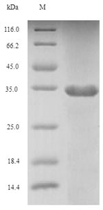 Recombinant Human Fibroblast growth factor 10(FGF10),partial