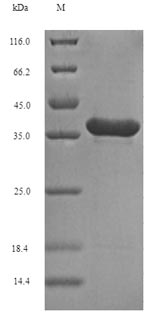 Recombinant Human Fibroblast growth factor 10(FGF10),partial