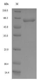 Recombinant Human F-box/WD repeat-containing protein 4(FBXW4)