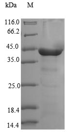 Recombinant Human Cytoplasmic dynein 2 light intermediate chain 1(DYNC2LI1)