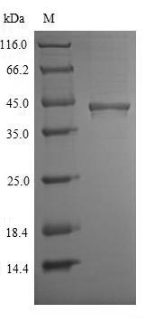 Recombinant Mouse Chitinase domain-containing protein 1(Chid1) ,partial
