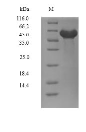 Recombinant Human Dual specificity tyrosine-phosphorylation-regulated kinase 2(DYRK2),partial