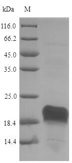 Recombinant Pig Heat shock protein HSP 90-alpha(HSP90AA1),partial