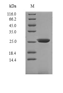Recombinant Mouse Interleukin-7 receptor subunit alpha(Il7r),partial