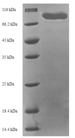 Recombinant Human Target of rapamycin complex 2 subunit MAPKAP1(MAPKAP1)