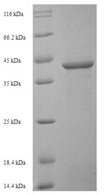 Recombinant Human Sialic acid-binding Ig-like lectin 15(SIGLEC15),partial