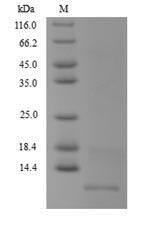 Recombinant Mycobacterium tuberculosis Antitoxin MT2731(MT2731)