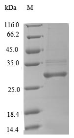 Recombinant Rat Complement factor D(Cfd)