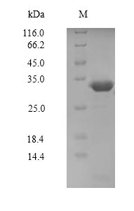 Recombinant Human Serine/threonine-protein kinase PAK 7(PAK7),partial