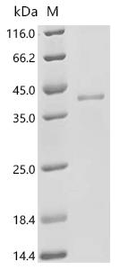 Recombinant Human Estrogen receptor beta(ESR2),partial