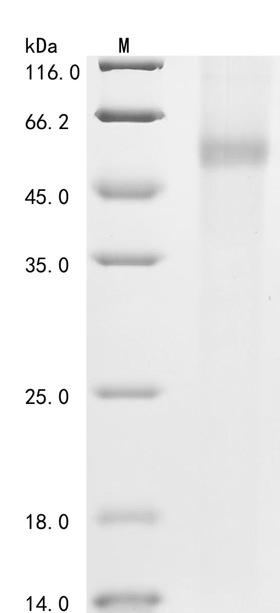 Recombinant Human Muscle, skeletal receptor tyrosine-protein kinase (MUSK), partial