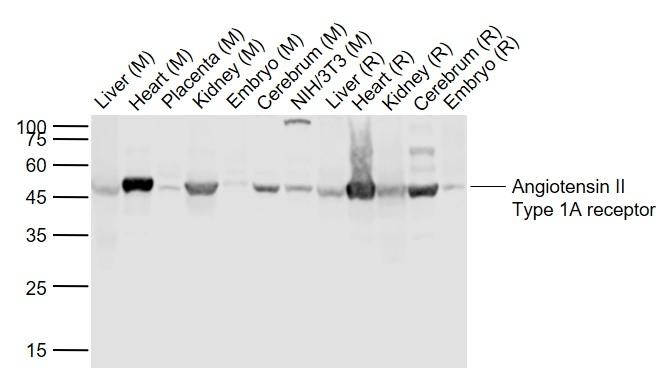 Angiotensin II type 1A receptor Antibody