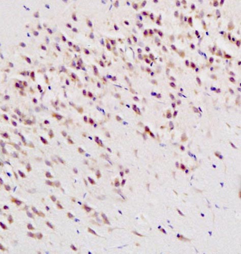 8-OHdG (DNA/RNA Damage) Rabbit pAb
