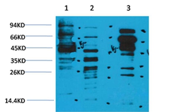 Acetyl-Lysine Rabbit Polyclonal Antibody
