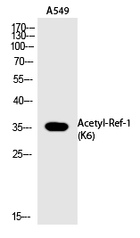 Ref (Acetyl-Lys6) Polyclonal Antibody