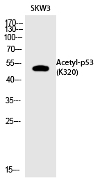 p53 (Acetyl-Lys320) Polyclonal Antibody