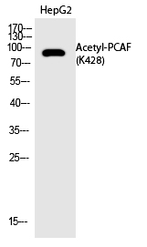 PCAF (Acetyl-Lys428) Polyclonal Antibody