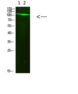 PARP (Acetyl-K521) Polyclonal Antibody