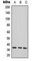 TAL1/2 (acetyl-Lys221+222/Lys36+37) Antibody