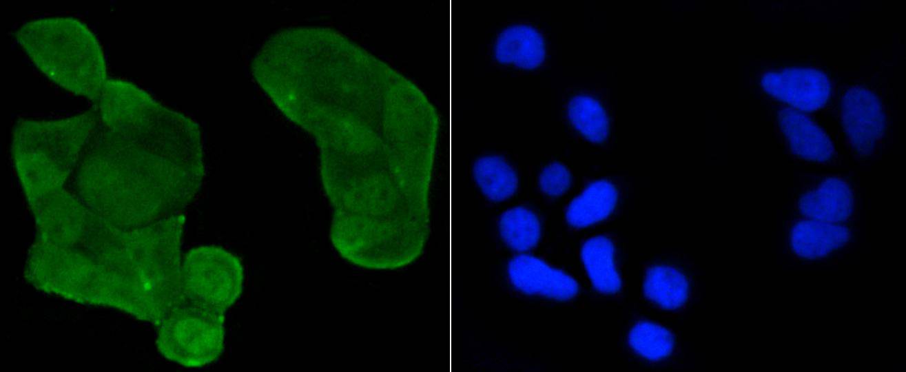 p53(acetyl K370) Antibody