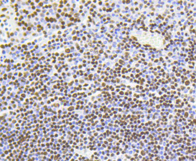 Histone H4(acetyl K5) Antibody