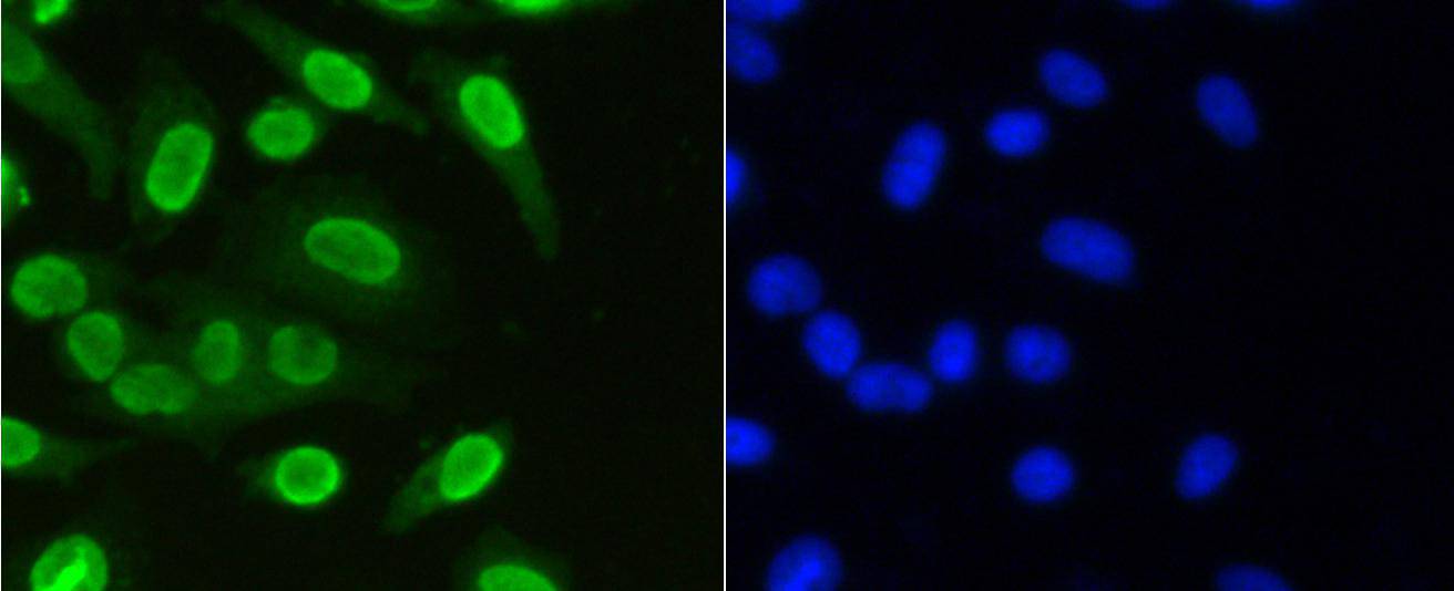 Histone H3(mono methyl K36) Antibody