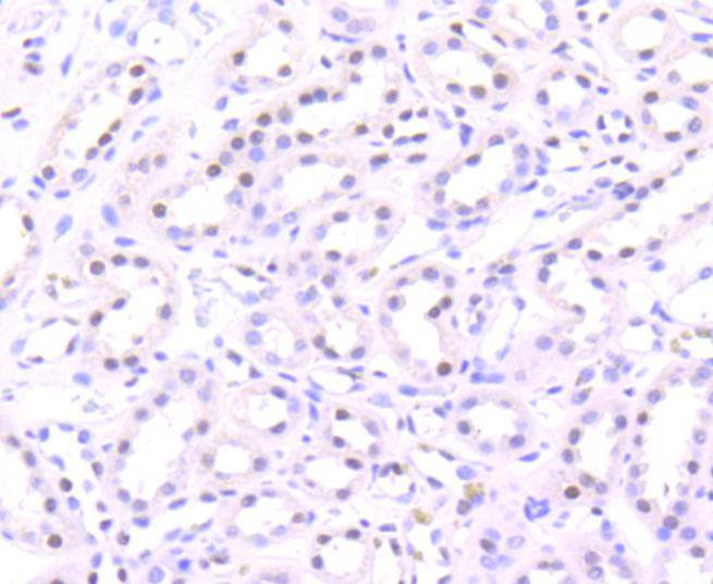 Histone H3(acetyl K56) Antibody
