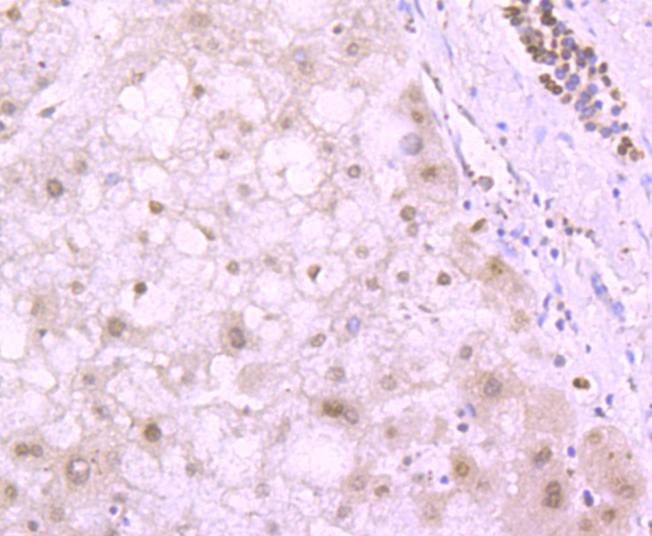 Histone H4 (tri methyl K20) Antibody