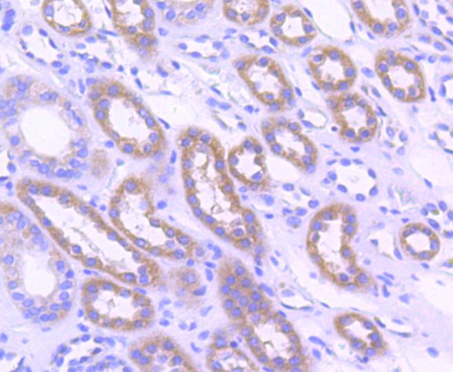 Acetyl CoA Carboxylase 1(ACC1) Antibody